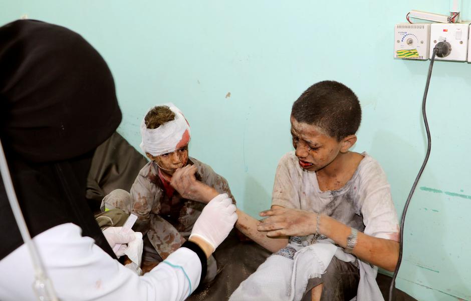Djeca žrtva bombardiranja u Jemenu | Author: NAIF RAHMA/REUTERS/PIXSELL/