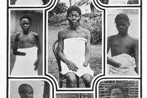 Belgijski kralj Leopold II i njegov afrički genocid