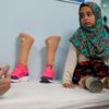 Sirijska djevojčica Maya Merhi sa limenkama na nogama umjesto proteze