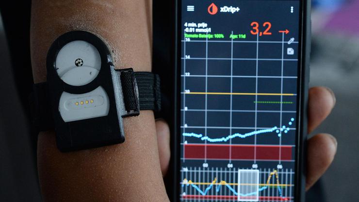 Senzor za mjerenje šećera u krvi