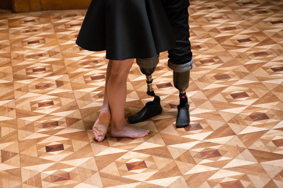 Ukrainian veteran dances on prosthetic legs with his wife for first time in Lviv
