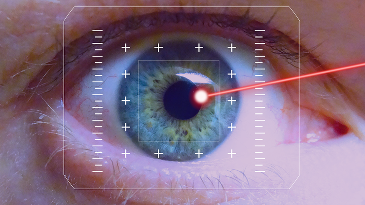 Oko tretirano laserom