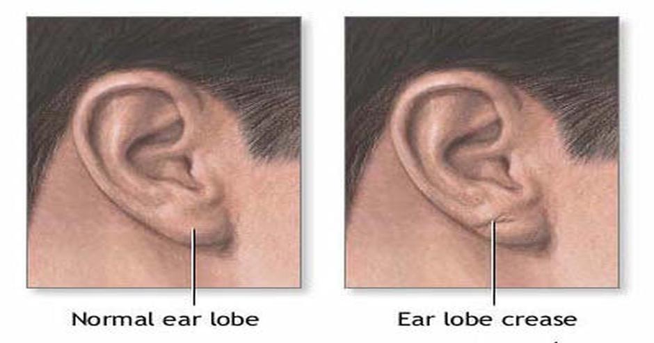 Frankov znak na ušima | Author: Wikimedia Commons