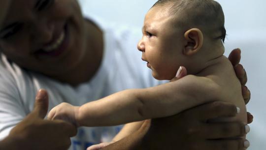 Zika virus