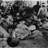 Victims Of Hiroshima Bombing