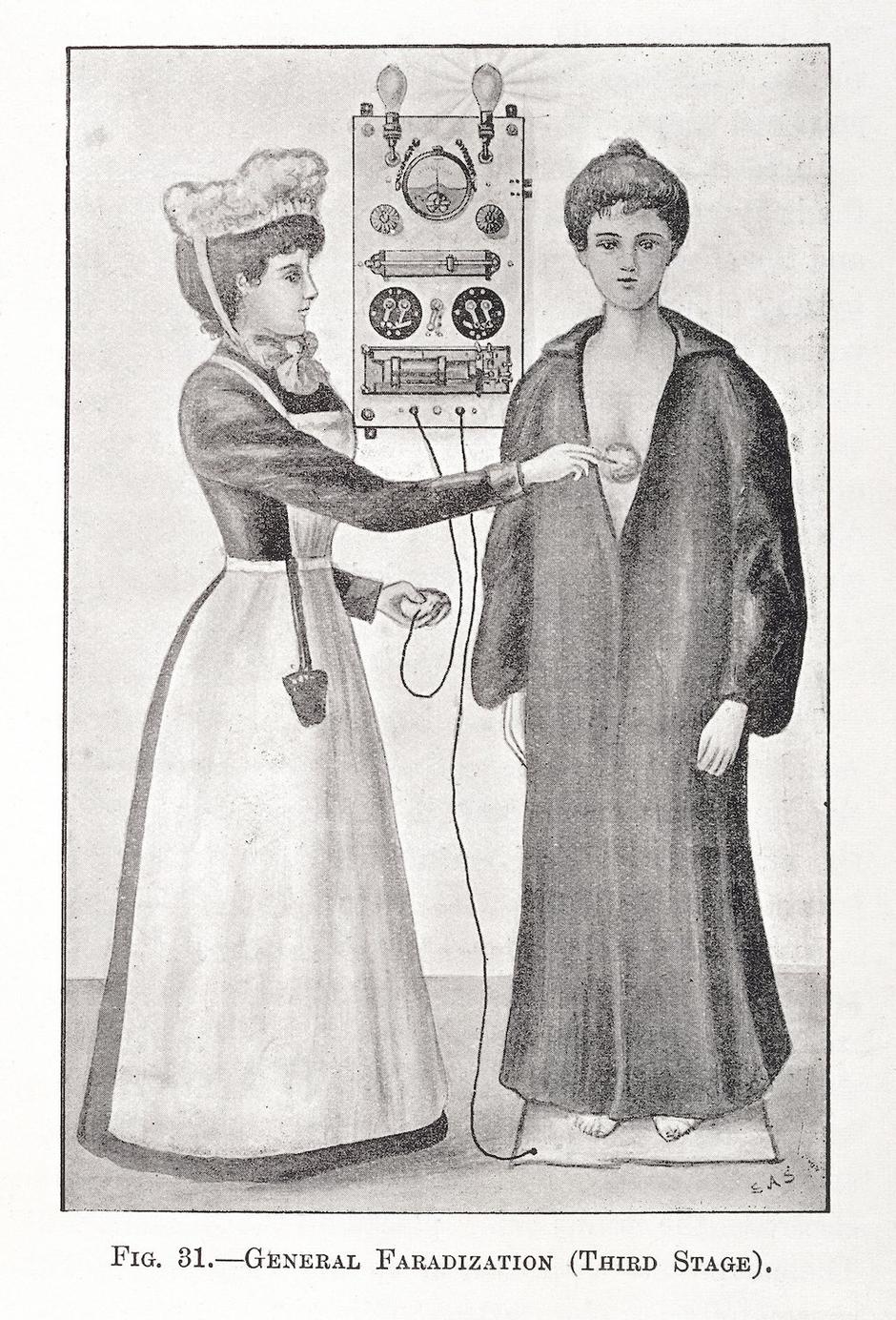 Prikaz rada prvih vibratora u knjizi Richarda Cowena | Author: Wellcome Library