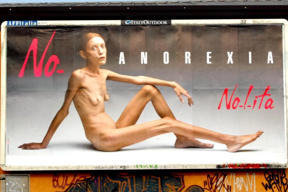 Anoreksija | Author: Emmevi Photo/Milestone Media/PIXSELL