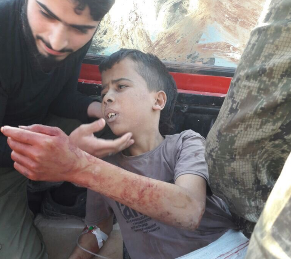 Smaknuti dječak Aleppo | Author: Twitter/ Die Welt