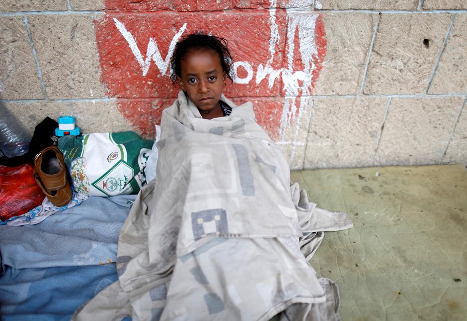 Djeca u Jemenu umiru od gladi | Author: Khaled Abdullah/REUTERS/PIXSELL