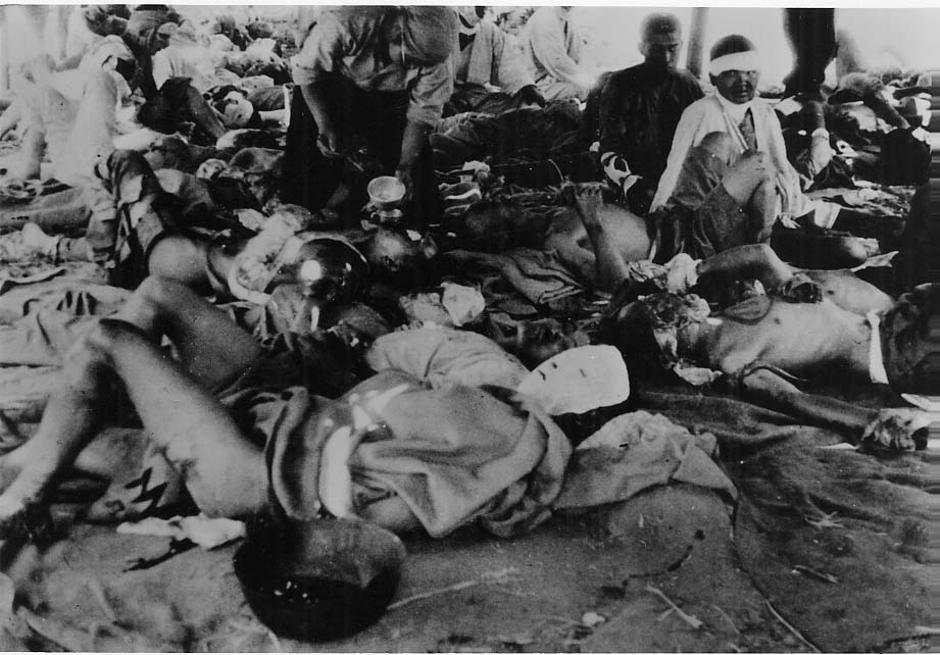 Victims Of Hiroshima Bombing | Author: Profimedia