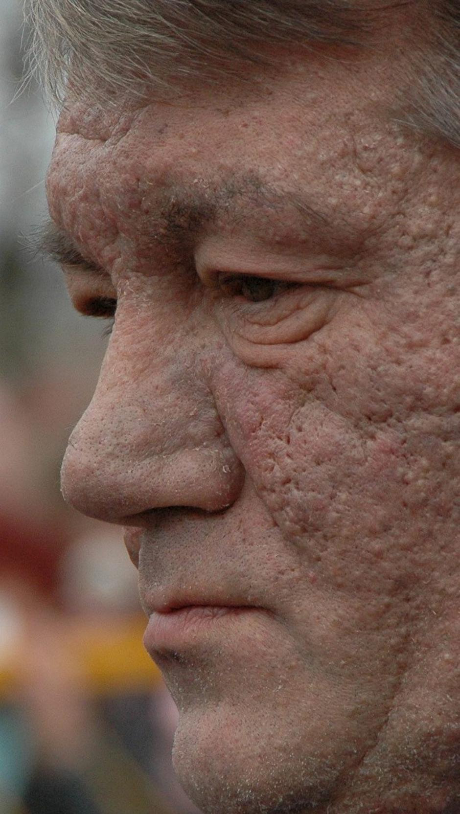 Viktor JUŠČENKO | Author: Profimedia