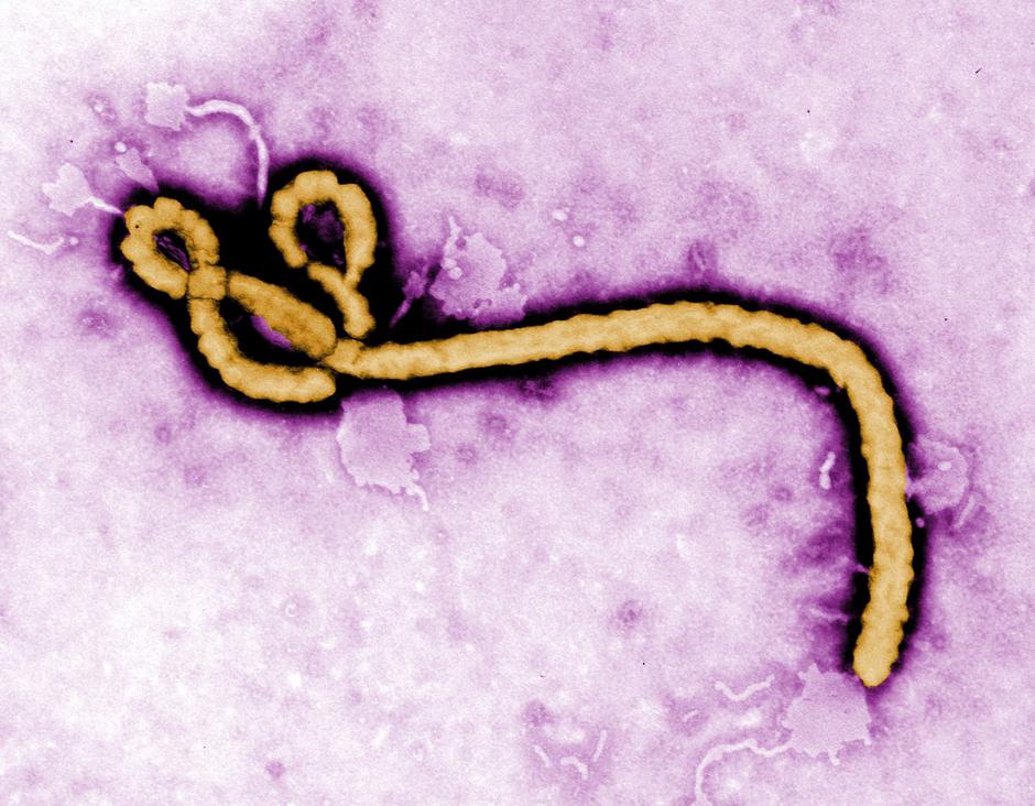 The Ebola virus | Author: Profimedia