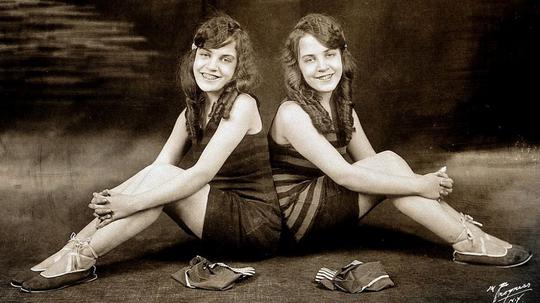 Daisy i Violet Hilton