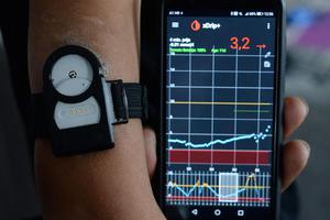 Senzor za mjerenje šećera u krvi