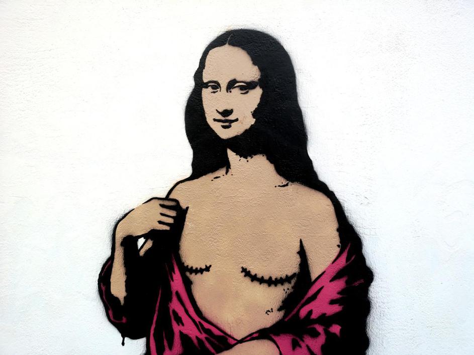 Mona Lisa With Mastectomy, The Mural By AleXsandro Palombo In Front Of The National Cancer Institute