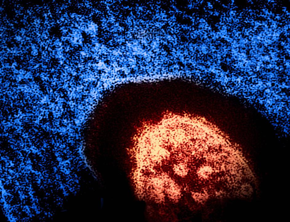 Brian W.J. Mahy, BSc, MA, PhD, ScD, DSc This transmission electron micrograph (TEM) revealed the ultrastructural appeara