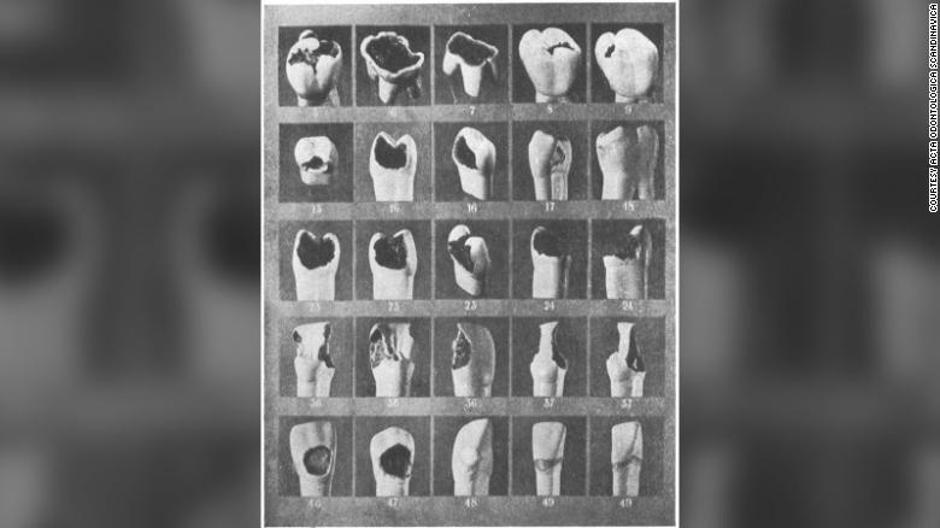 Povijest stomatologije u fotografijama | Author: Odontologica Scandinavica