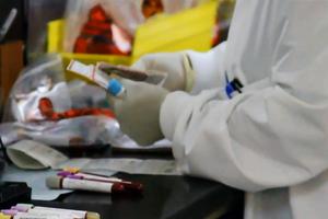 Kronična mijeloična leukemija, traženje lijeka u laboratoriju