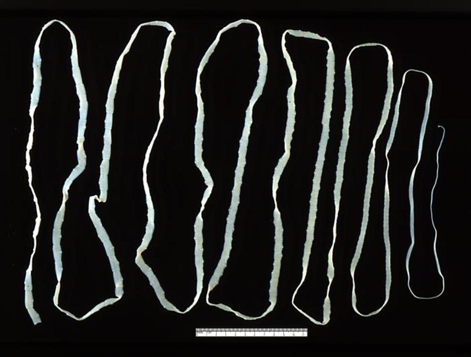Prikaz parazita koji inficiraju ljude | Author: Wikimedia Commons
