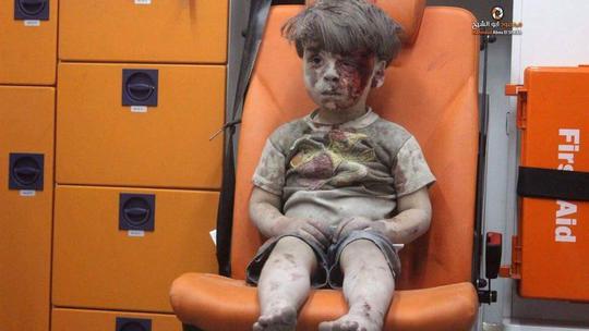Omran Daqneesh