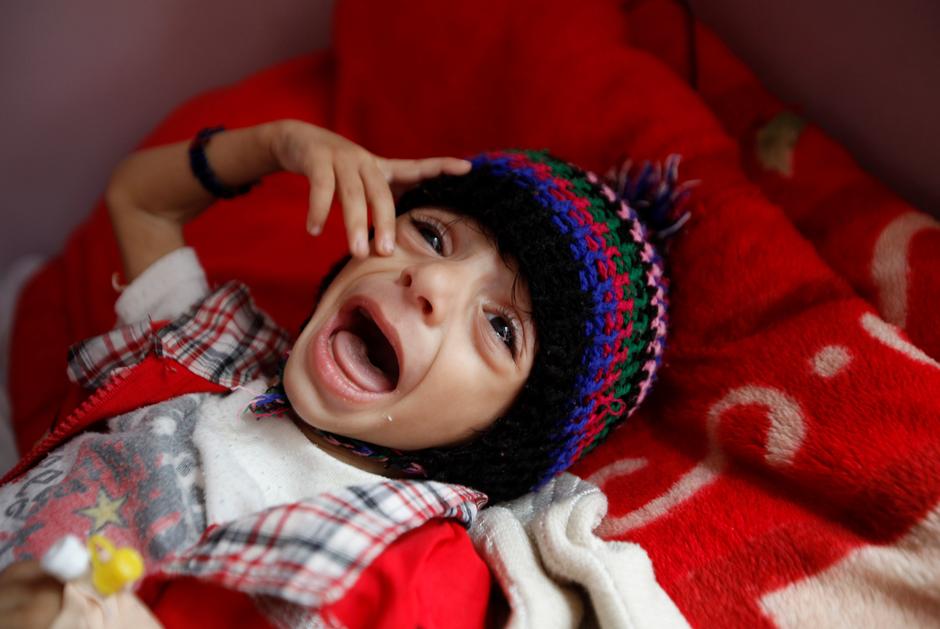 Jemenu zaprijetila glad | Author: Reuters/Pixsell