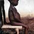 Nigerija, glad u pokrajini Biafra u 1960-ima, izgladnjela djevojčica