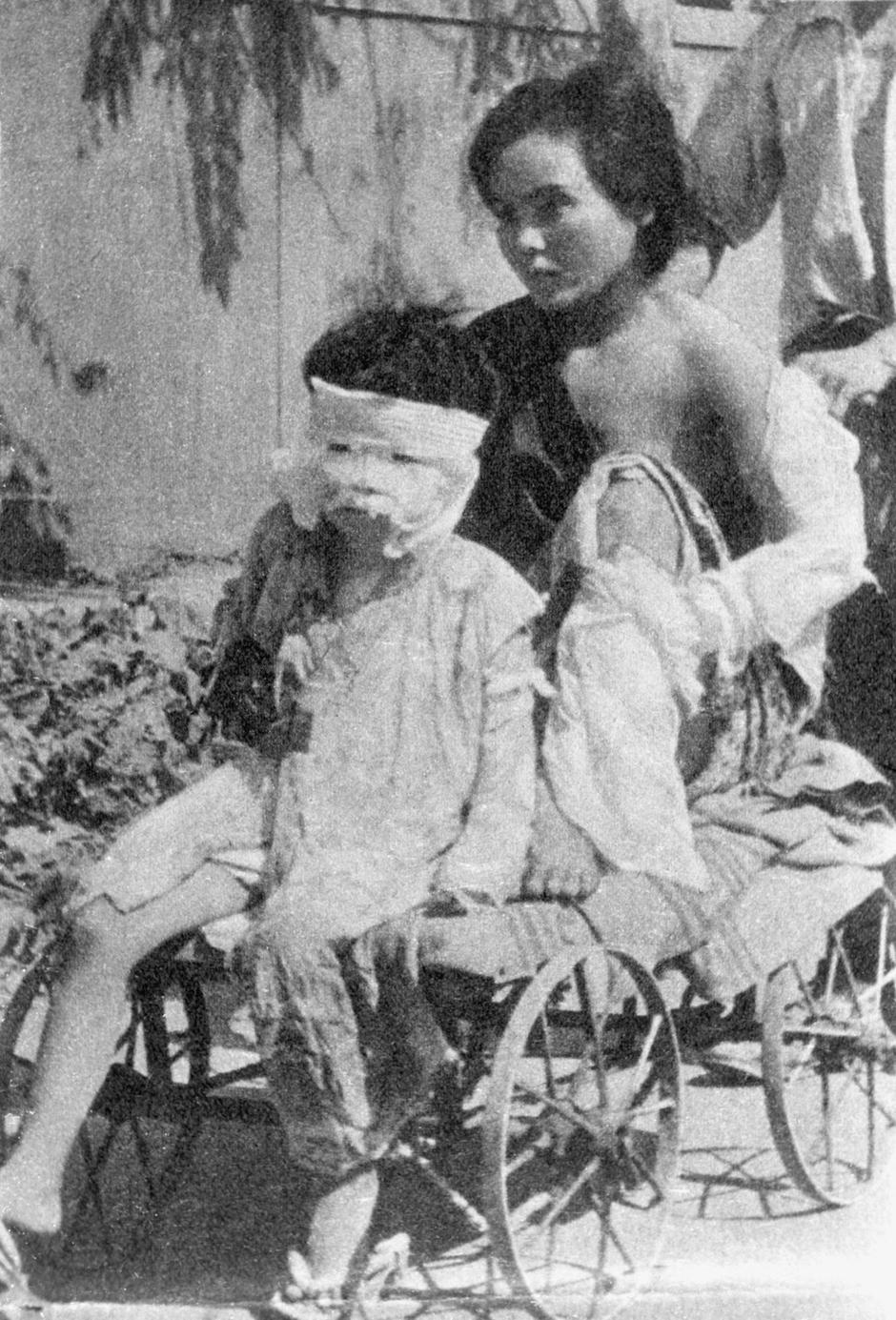 VICTIMS OF THE ATOMIC BOMBARDMENT | Author: Profimedia