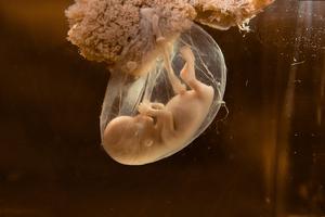 Ljudski embrij