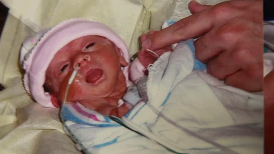 Prerano rođeno dijete | Author: Wikipedia Commons
