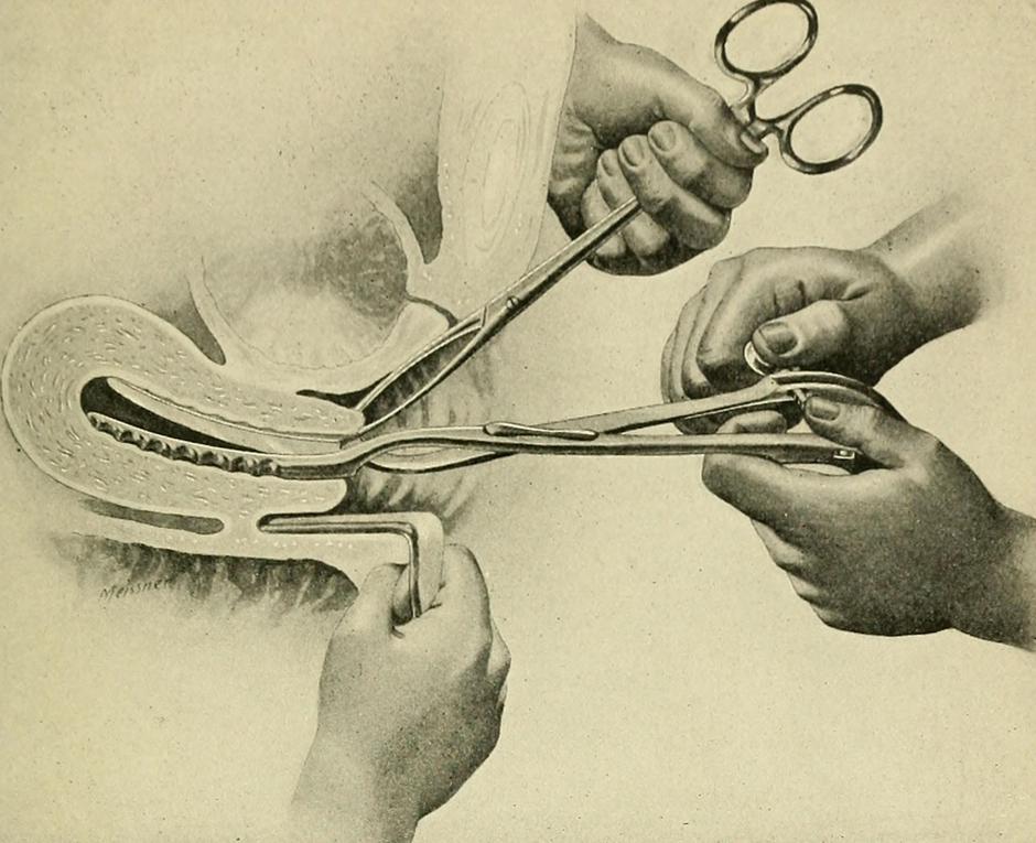 "Principi i praksa ginekologije", udžbenik iz 1904. | Author: Flickr