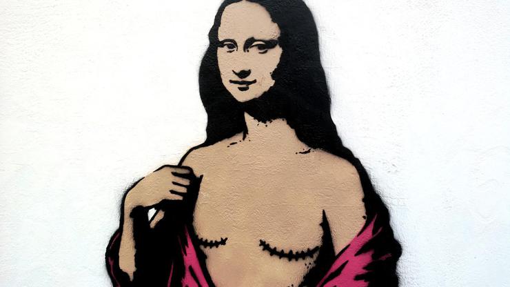 Mona Lisa With Mastectomy, The Mural By AleXsandro Palombo In Front Of The National Cancer Institute