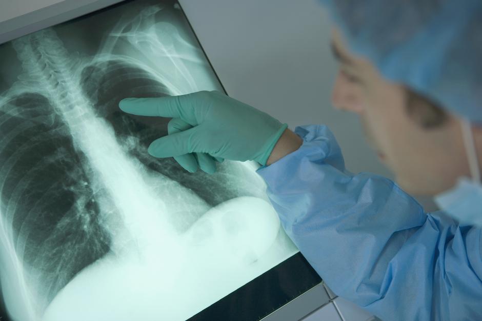 Liječnik pregledava pluća | Author: Thinkstock