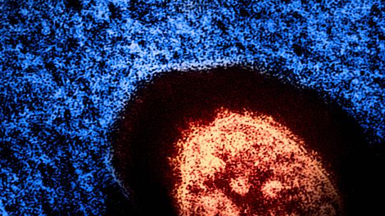 Brian W.J. Mahy, BSc, MA, PhD, ScD, DSc This transmission electron micrograph (TEM) revealed the ultrastructural appeara