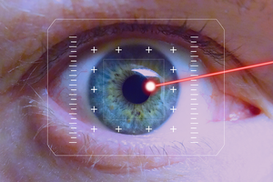 Oko tretirano laserom