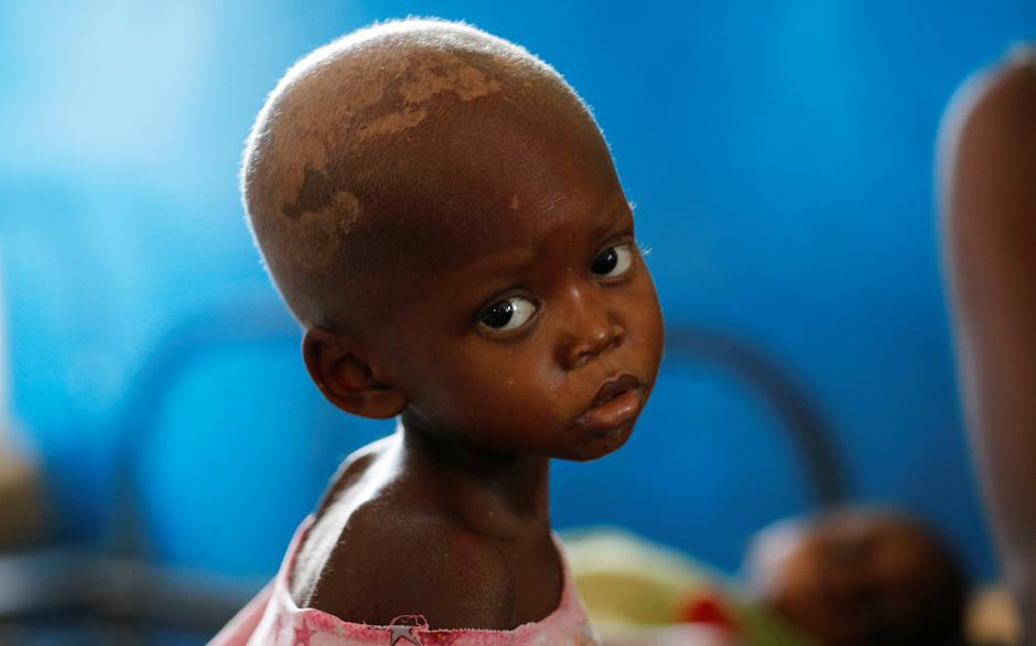 Djevojčica iz Konga | Author: THOMAS MUKOYA/REUTERS/PIXSELL
