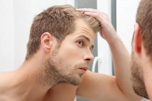 Muškarac u ogledalu promatra gubitak kose