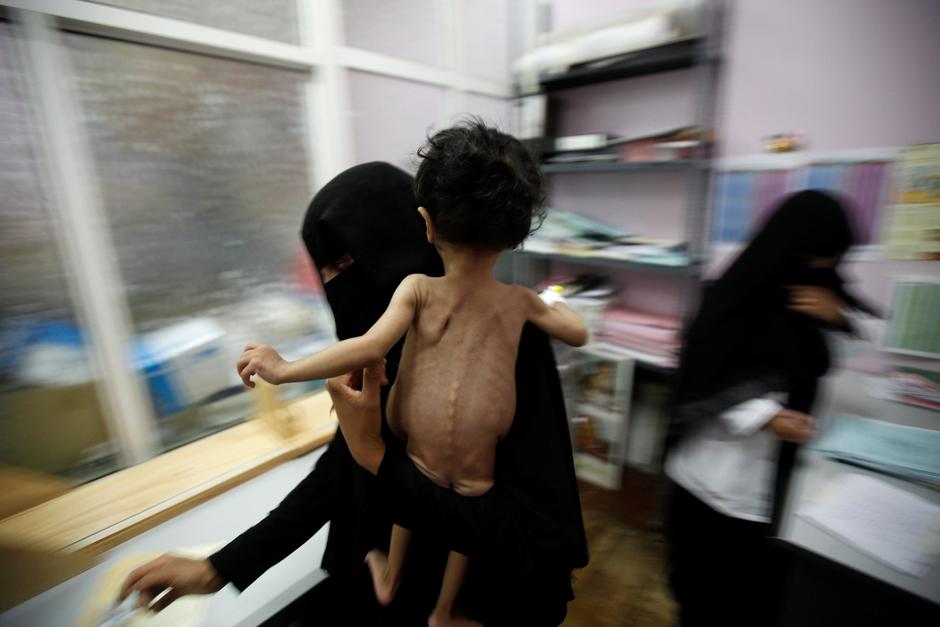 Jemenu zaprijetila glad | Author: Reuters/Pixsell