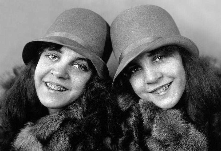 Daisy i Violet Hilton | Author: Wikimedia Commons