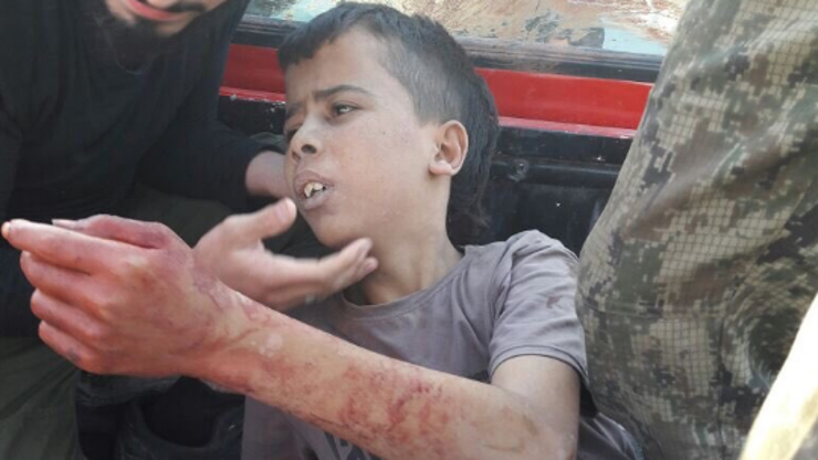 Smaknuti dječak Aleppo
