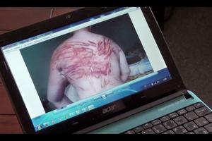 Žrtva mučenja u Ukrajini koja je još dobro i prošla