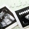 Snimka razvoja fetusa